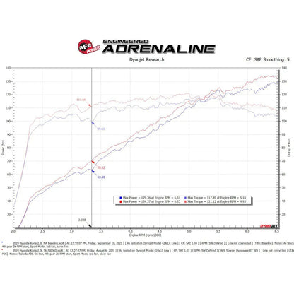 aFe Momentum Cold Air Intake | Hyundai Kona L4 2.0L (17-23) (56-70036D)