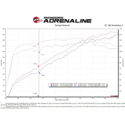 aFe Momentum Cold Air Intake System | Hyundai Kona Electric (56-70036R)