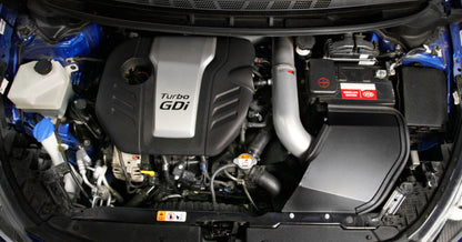 K&N 69-5316TS Short Ram Intake For Kia Forte Coup L4-1.6L F/I 14-16