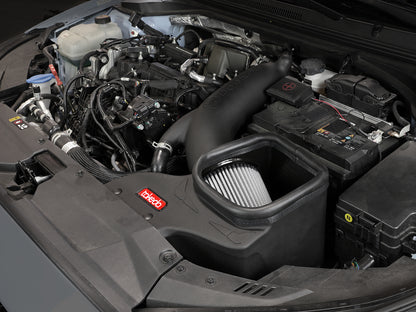 aFe Takeda Stage-2 Pro Dry S AIS 4" Intake | Hyundai Veloster N 2019-2020 (56-10021D)