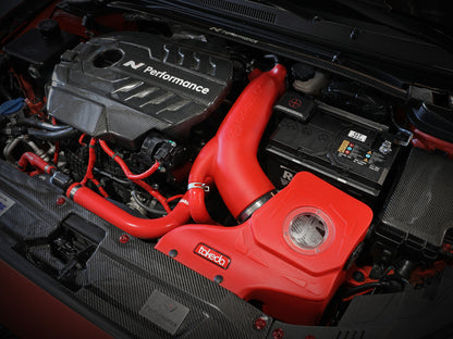 aFe Momentum Cold Air Intake w/ Pro DRY S Filter | Hyundai Veloster N 2.0L (19-20) (56-70021DR)