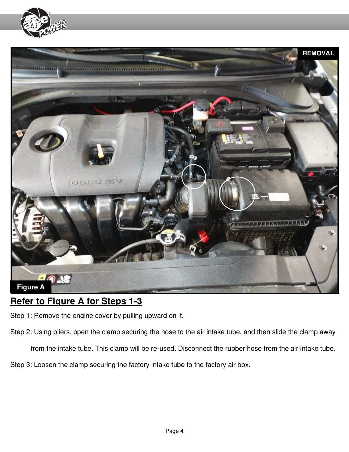 aFe Takeda Momentum Pro DRY S Cold Air Intake | Hyundai Elantra L4 2.0L (16-20) (56-70024D)
