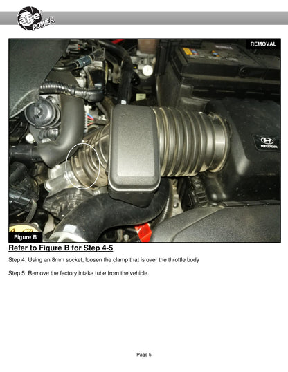aFe Takeda Momentum Pro DRY S Cold Air Intake | Hyundai Elantra L4 2.0L (16-20) (56-70024D)