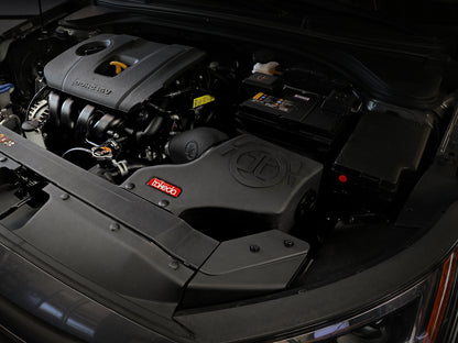 aFe Takeda Momentum Pro DRY S Cold Air Intake | Hyundai Elantra L4 2.0L (16-20) (56-70024D)