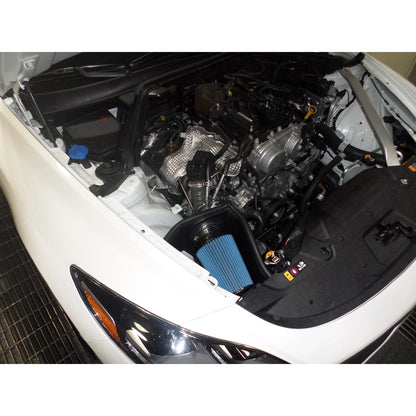 Injen Short Ram Air Intake | Kia Stinger / Genesis G70 (18+ / 17-24) (SP1355P)
