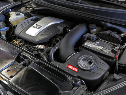 aFe Takeda Momentum Pro DRY S Cold Air Intake | Hyundai Veloster (13-17) (56-70028D)