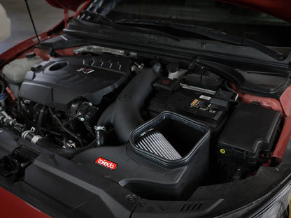 aFe Takeda Stage-2 Pro Dry S AIS 4" Intake | Hyundai Veloster N 2019-2020 (56-10021D)