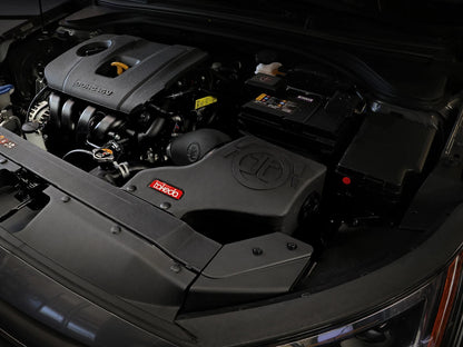 aFe Takeda Momentum Pro DRY S Cold Air Intake | Hyundai Elantra L4 2.0L (16-20) (56-70024D)