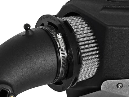 aFe POWER Momentum GT Pro Dry S Intake System | BMW 330i F30 (16-17) (51-76312)
